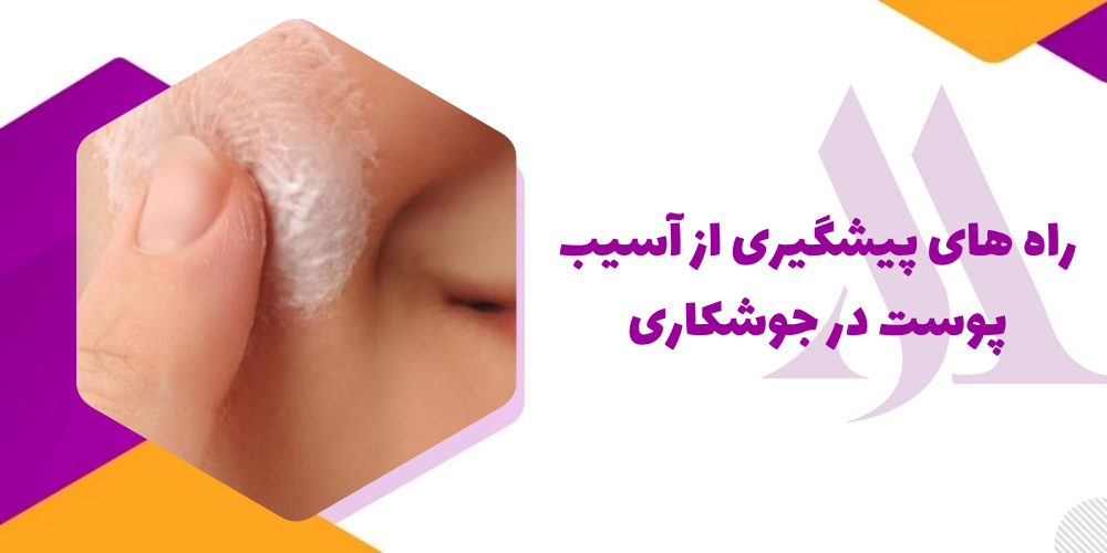 راه های پیشگیری از آسیب پوست در جوشکاری